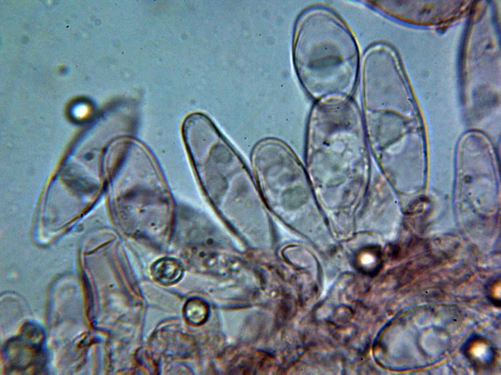 Microscopía de Pluteus romellii - 10 - Queilocistidios 1